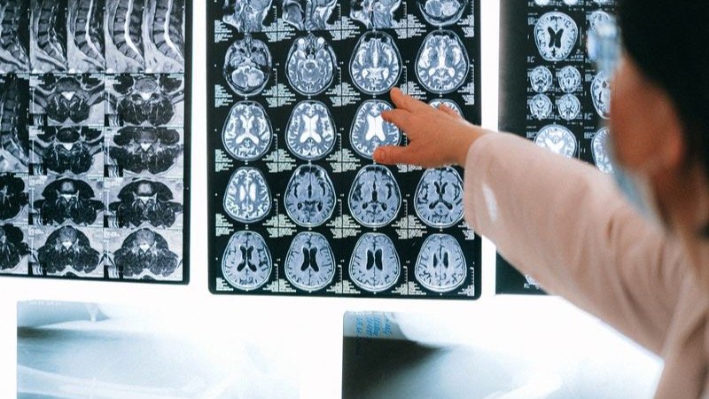 Radiation Therapy